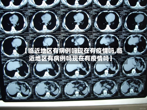 【临近地区有病例吗现在有疫情吗,临近地区有病例吗现在有疫情吗】